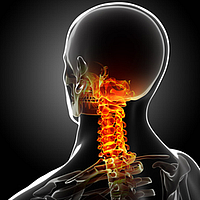 ból kręgosłupa szyjnego